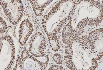 PC4/SUB1 Mouse Monoclonal Antibody