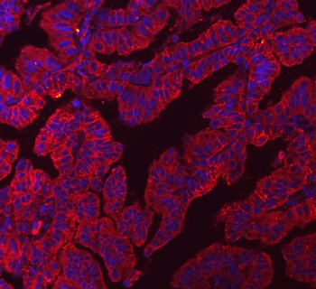 Claudin 3/CLDN3 Mouse Monoclonal Antibody
