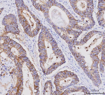 Claudin 3/CLDN3 Mouse Monoclonal Antibody
