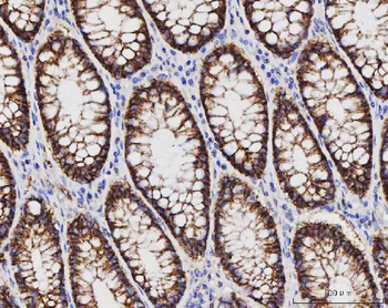 Claudin 3/CLDN3 Mouse Monoclonal Antibody