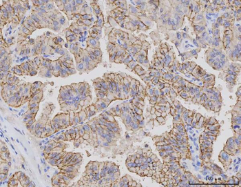 Claudin 3/CLDN3 Mouse Monoclonal Antibody