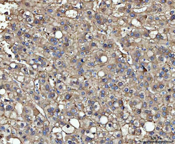 ME1 Mouse Monoclonal Antibody