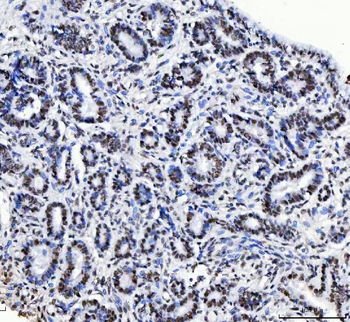 CPSF6 Mouse Monoclonal Antibody