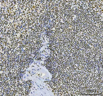 CPSF6 Mouse Monoclonal Antibody