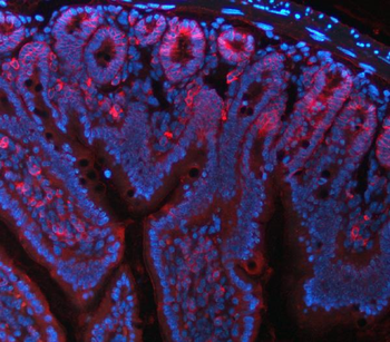 NKCC1/SLC12A2 Mouse Monoclonal Antibody