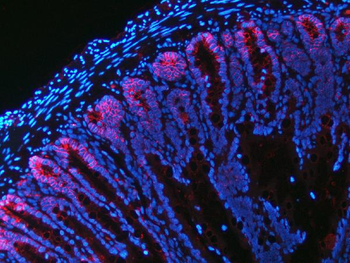 NKCC1/SLC12A2 Mouse Monoclonal Antibody