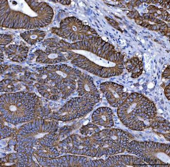 NKCC1/SLC12A2 Mouse Monoclonal Antibody
