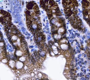 NKCC1/SLC12A2 Mouse Monoclonal Antibody