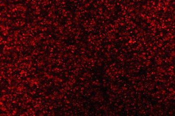 AREB6/ZEB1 Mouse Monoclonal Antibody