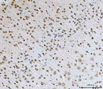 AREB6/ZEB1 Mouse Monoclonal Antibody