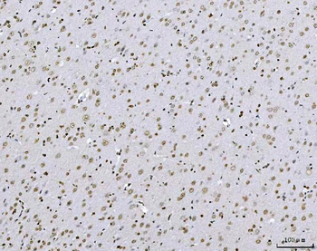 AREB6/ZEB1 Mouse Monoclonal Antibody