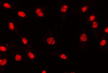 AREB6/ZEB1 Mouse Monoclonal Antibody