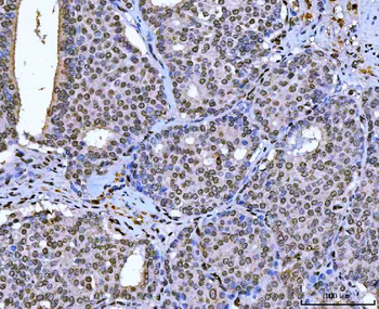 AREB6/ZEB1 Mouse Monoclonal Antibody