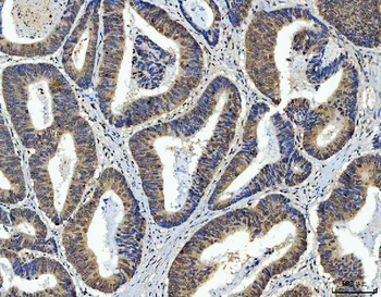 AREB6/ZEB1 Mouse Monoclonal Antibody
