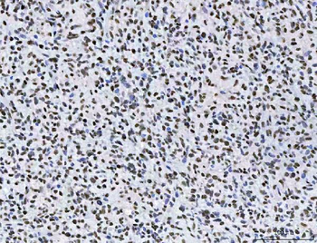 AREB6/ZEB1 Mouse Monoclonal Antibody