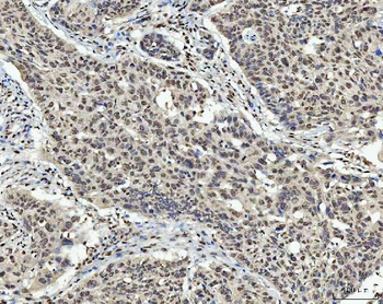 AREB6/ZEB1 Mouse Monoclonal Antibody