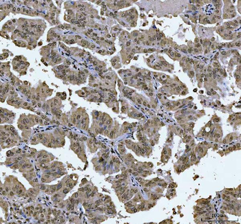 AREB6/ZEB1 Mouse Monoclonal Antibody