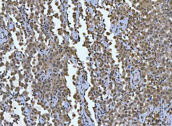 AREB6/ZEB1 Mouse Monoclonal Antibody