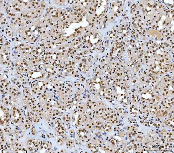 AREB6/ZEB1 Mouse Monoclonal Antibody