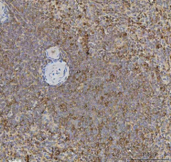 CCXCR1/XCR1 Rabbit Polyclonal Antibody