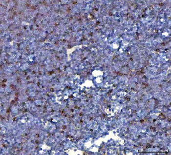 CCXCR1/XCR1 Rabbit Polyclonal Antibody