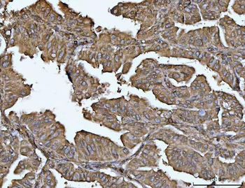 VPS53 Rabbit Polyclonal Antibody