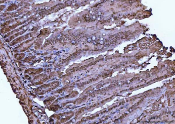 VCP Rabbit Polyclonal Antibody