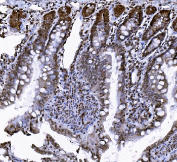 VCP Rabbit Polyclonal Antibody