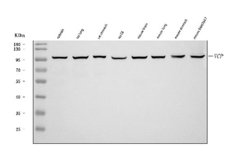 VCP Rabbit Polyclonal Antibody