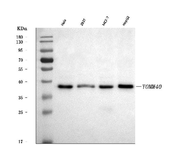 TOMM40 Rabbit Polyclonal Antibody