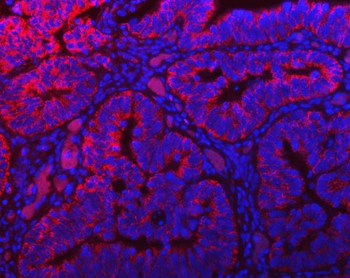 TOMM40 Rabbit Polyclonal Antibody
