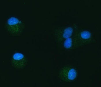 TOMM40 Rabbit Polyclonal Antibody