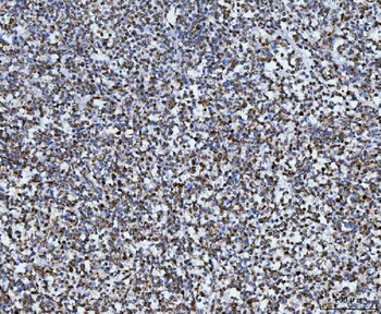 TOMM40 Rabbit Polyclonal Antibody