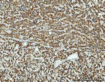 TOMM40 Rabbit Polyclonal Antibody