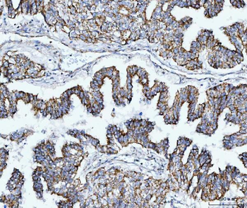 TOMM40 Rabbit Polyclonal Antibody