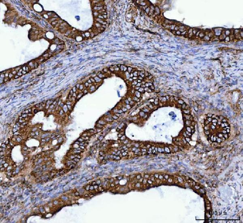TOMM40 Rabbit Polyclonal Antibody