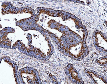TOMM40 Rabbit Polyclonal Antibody