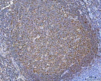 TOMM40 Rabbit Polyclonal Antibody