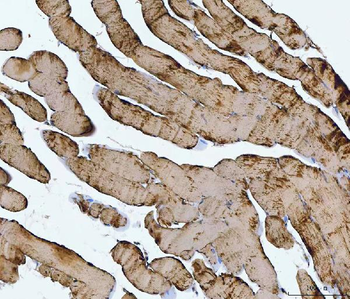 TNNI1 Rabbit Polyclonal Antibody