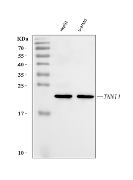 TNNI1 Rabbit Polyclonal Antibody