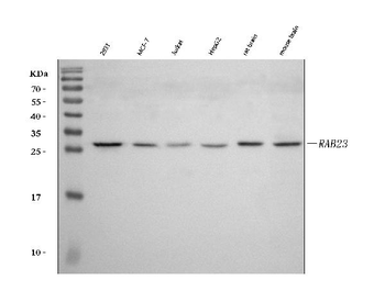 RAB23 Rabbit Polyclonal Antibody