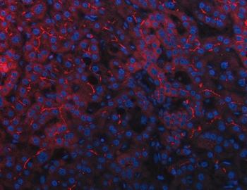 DEP1/PTPRJ Rabbit Polyclonal Antibody