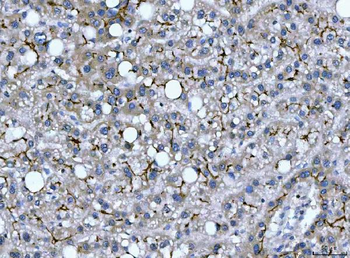 DEP1/PTPRJ Rabbit Polyclonal Antibody