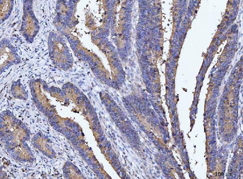 DEP1/PTPRJ Rabbit Polyclonal Antibody