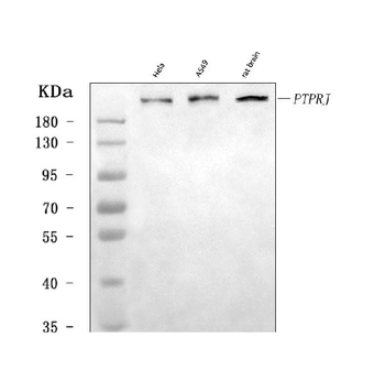DEP1/PTPRJ Rabbit Polyclonal Antibody