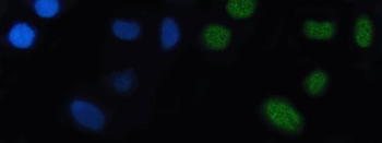 Nkx2.5/NKX2-5/NKX2 Rabbit Polyclonal Antibody