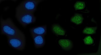 KLF10 Rabbit Polyclonal Antibody