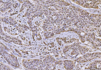 hnRNP U/p120/HNRNPU Rabbit Polyclonal Antibody