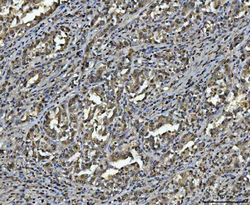 hnRNP U/p120/HNRNPU Rabbit Polyclonal Antibody