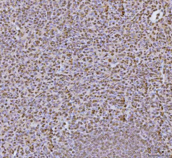 hnRNP U/p120/HNRNPU Rabbit Polyclonal Antibody